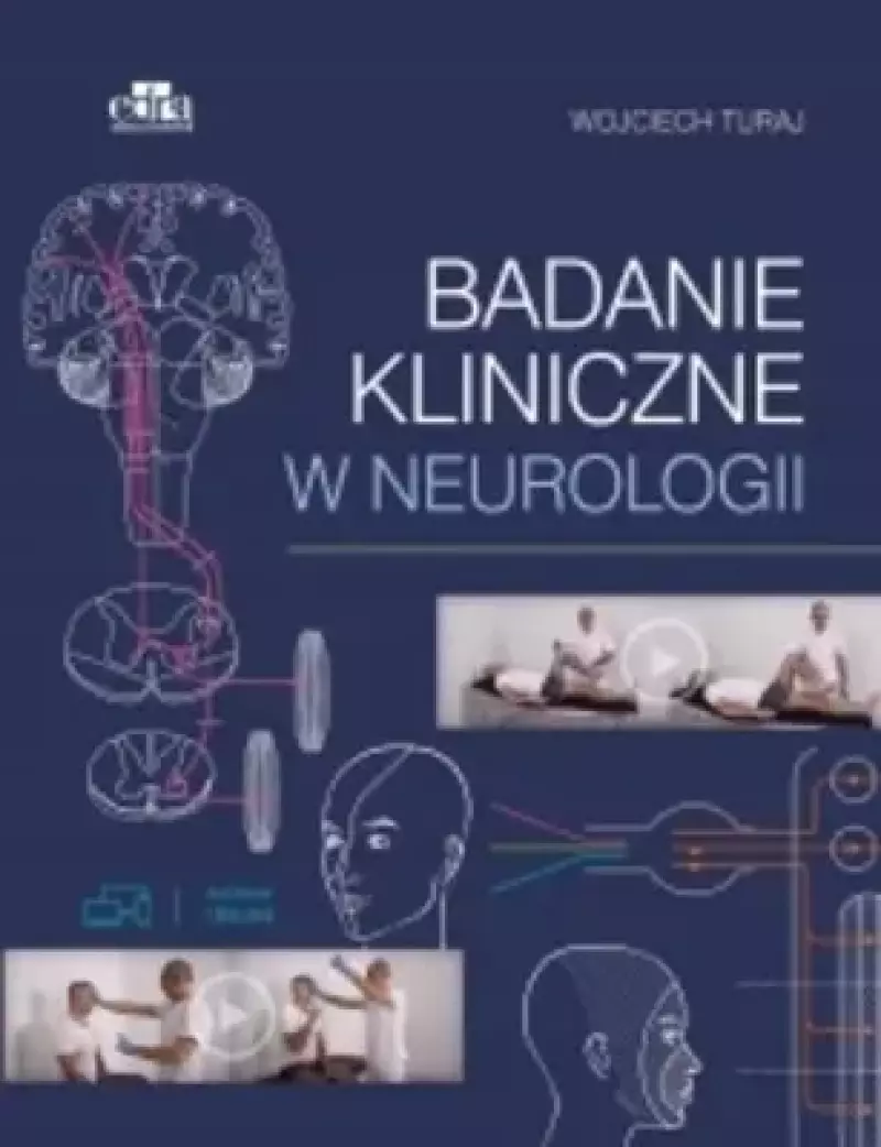 Badanie kliniczne w neurologii
