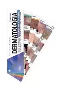 Dermatologia. Diagnostyka różnicowa, zdjęcie 2
