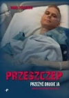Przeszczep Przeszczep - zdjęcie