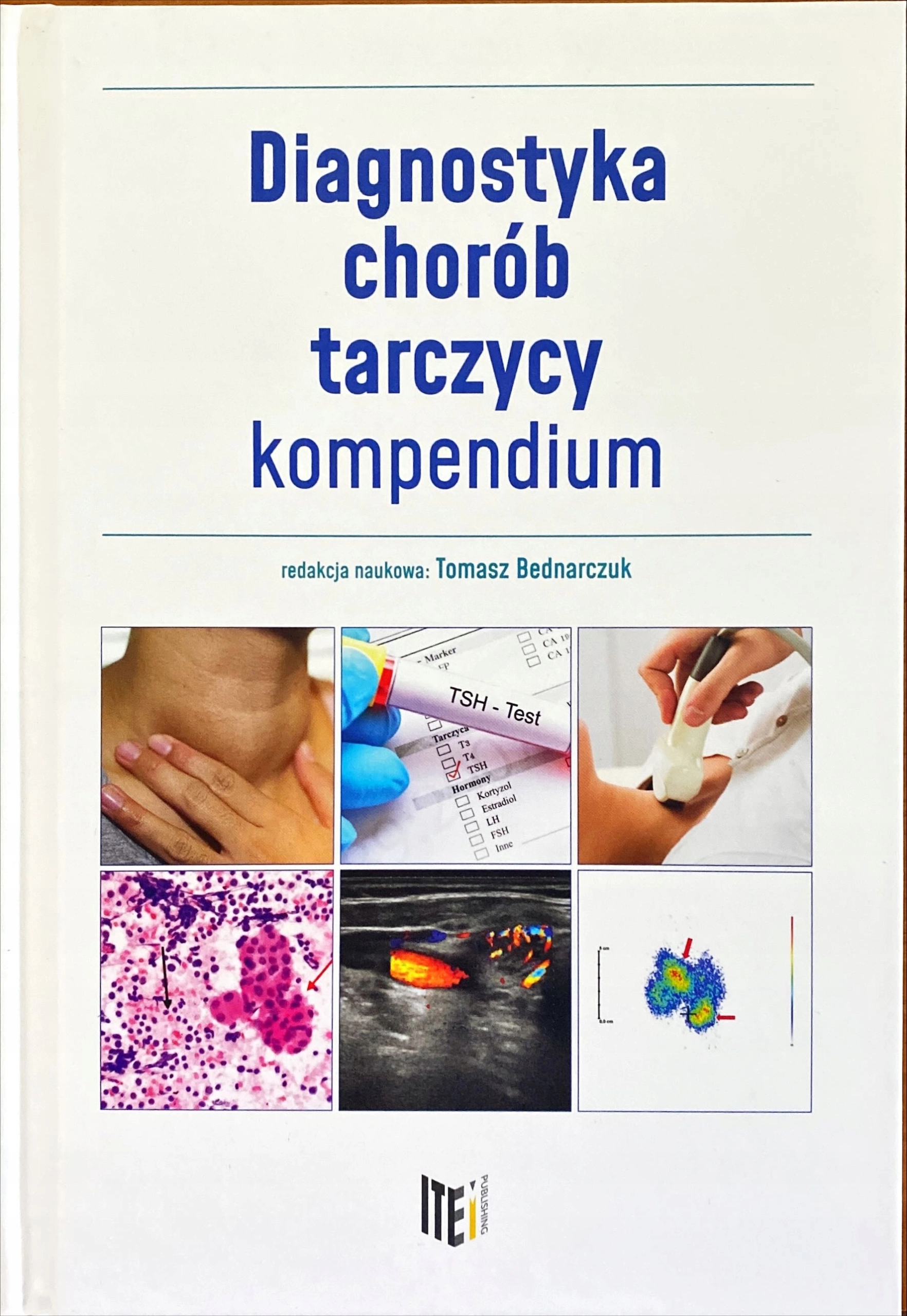 Diagnostyka chorób tarczycy - kompendium