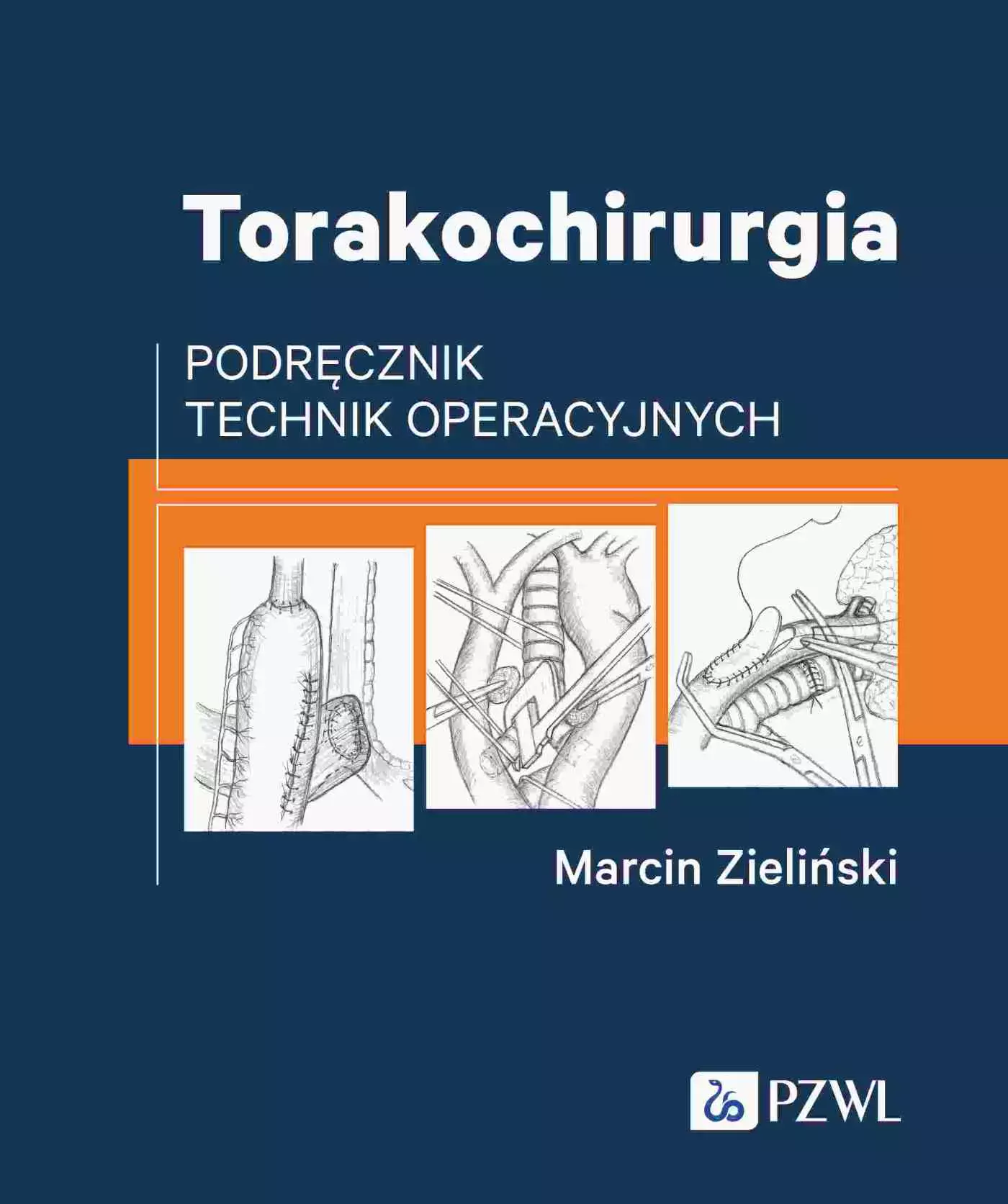Torakochirurgia. Podręcznik technik operacyjnych - Książki
