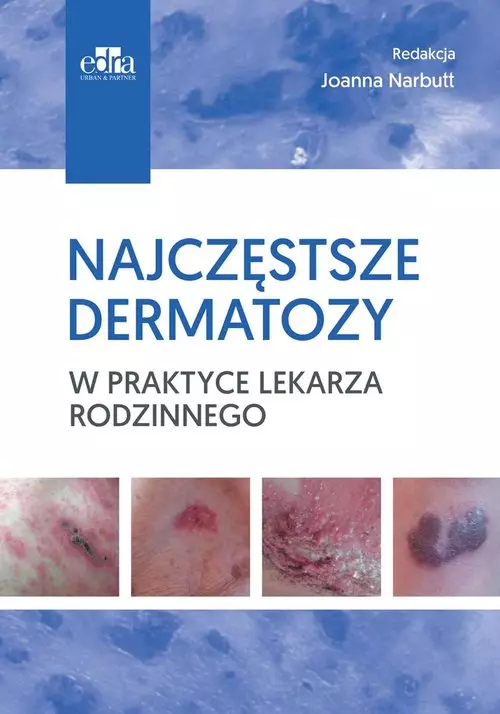 Najczęstsze dermatozy w praktyce lekarza rodzinnego - Książki